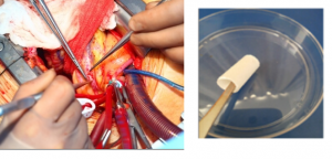 Blood vessels may be 3D printed in future
