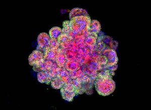 ’Mini human placenta’ may help prevent reproductive disorders