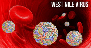 west nile virus